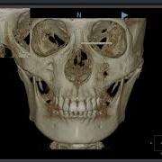 3D Ceph Compare
