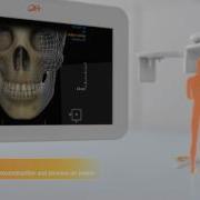 RayScan