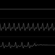 Wiklund Megamix C64 Oscilloscope View
