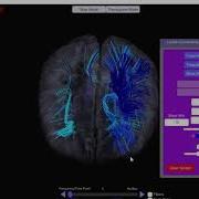Neuroguide Connectivity Previous Version