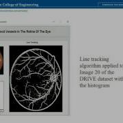 EEL6512 ImageProcessing Retinal Vessel Segmentation Algorithms In MATLAB