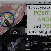 Introduction To The X Guide Dynamic 3D Navigation System