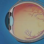 Understanding Glaucoma