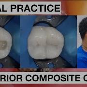 Dental Practice Class I Composite Restoration General Dentist Griya RR