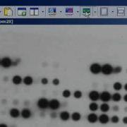 Gene Array Analysis Using HLImage