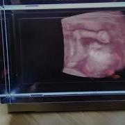 RSNA 2023 Kitware Demo VolView For Holographic Visualizations