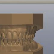 How To View Your Digital Study Models