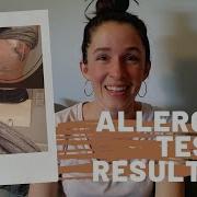 1st Patch Test Experience Allergy Test 42 Allergy Samples