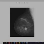 Histogram Equalization Program