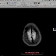 Support For Low And High Resolution Monitors In OsiriX