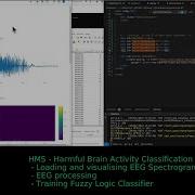 Mastering EEG Data Visualization Plotly Vs Chart Js Showdown