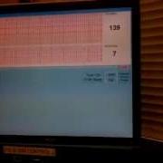 Using Adder Command Control With Simulation 2