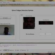 Driver Fatigue Detection System Matlab