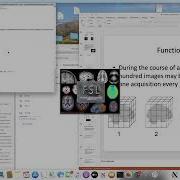 DPABI Preprocessing Seminar Spring 2022