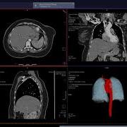 Region Growing Anatomy Visualizer طريقه عرض كل عضو بلون منفصل