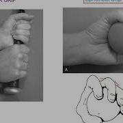 Spherical Grip WRIST AND HAND COMPLEX