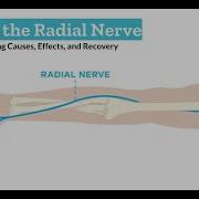 Radial Nerve Injury What You Need To Know