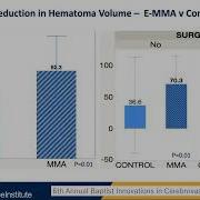 MMA Embolization For Chronic Subdural Hematomas