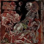 Artery Eruption Choking On Bile Devourment Cover