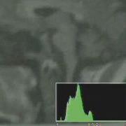 Wavelet Technologies