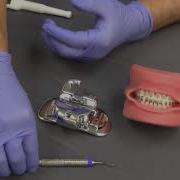 American Orthodontics Empower Self Ligating Braces Opening And Closing Product Manager Video FINAL