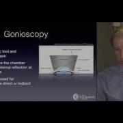 The Glaucoma Evaluation ARCHIVE