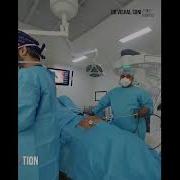 Docking Of Surgical Robot Da Vinci Xi