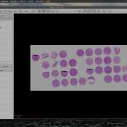 QuPath Exporting TMA Cores