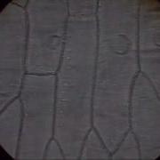 Onion Cells Under Microscope