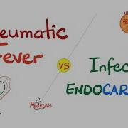 Rheumatic Fever Vs Infective Endocarditis Comparison Cardiology Series