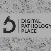 44 Weakly Supervised AI For Pathology W Geert Litjens RadboudUMC