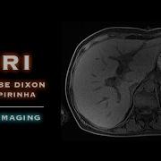 MRI T1w VIBE Dixon W CAIPIRINHA Liver Imaging