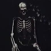 Bones LookWhatWeHaveHere Legendado
