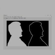 Boundary Extraction Using Dilation MATLAB