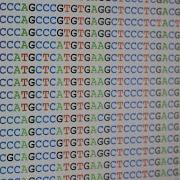 Example Of Pairwise Sequence Alignment