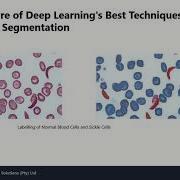 Demystifying Deep Learning Semantic Segmentation