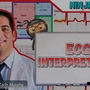 ECG Interpretation Clinical Medicine