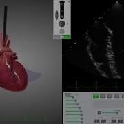 MPR TEE Simulation Trainer