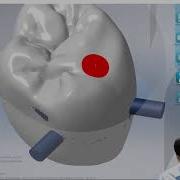 MillBox 2019 Hybrid Abutment And Screw Retained Workflow