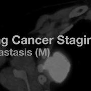 Lung Cancer Staging Metastasis M