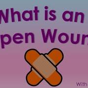 What Is An Open Wound