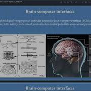 Lecture 15 Brain Computer Interfaces COGSCI 1 UC Berkeley