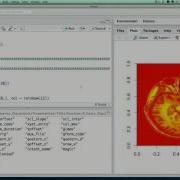 Neuroimaging Analysis In R Image Preprocessing