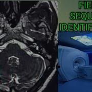 MRI BRAIN FIESTA SEQUENCE FIESTA CISS SEQUENCES IDENTIFICATION FIESTA PROTOCOL
