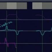 Lecture 29 Image Segmentation I