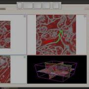 Ilastik 0 5 Neuron Classification 3D Workflow