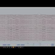 Pre Processing EEG Data Using EEGLAB GUI