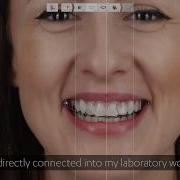 Make It Easy For Your Patients With 3Shape Smile Design