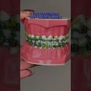 HOW TO FLOSS AND BRUSH YOUR TEETH WITH BRACES BRACES JOURNEY TIPS