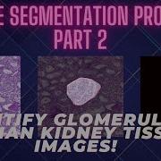 Image Segmentation Problem Using Deep Learning PART 2